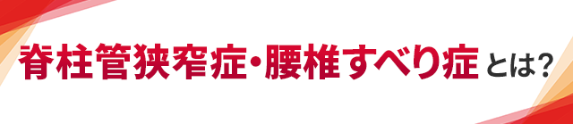 脊柱管狭窄症・腰椎すべり症とは？